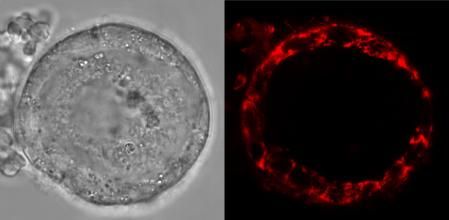 Imagen de un folículo humano