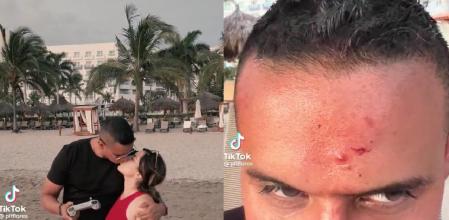 Intenta captar un romántico momento con un dron y acaba con heridas en la cabeza