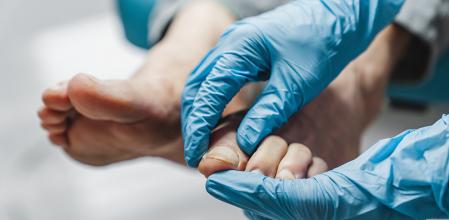 El cuidado de los pies es fundamental para prevenir infecciones