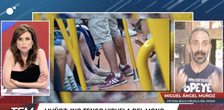 La víctima del bulo de la viruela del mono da la cara en ‘Todo es mentira’ y niega la enfermedad