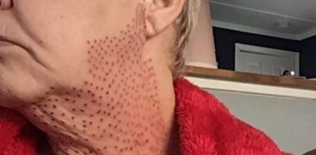 El resultado de la operación fue un desastre