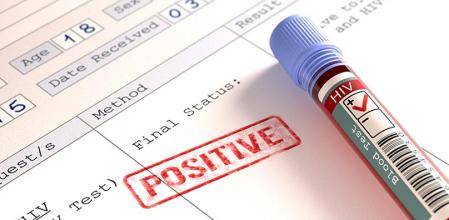 Imagen de archivo que muestra el positivo de una prueba del VIH&nbsp;