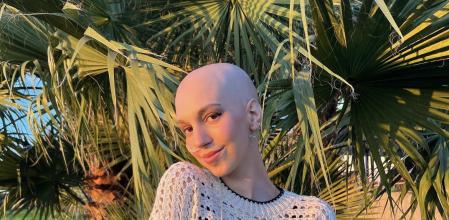 Elena Huelva se ganó la simpatía y la admiración de las redes sociales por su positivismo ante una adversidad tan grande como el Sarcoma de Ewing.