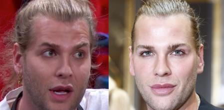 El diseñador Eduardo Navarrete se ha sometido a una cirugía de contorno corporal