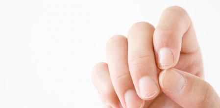 Hand on the white background. Dry, damage nails. Woman's issues. Problem and solution. Empty place for text.