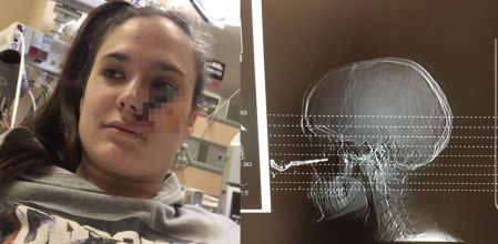 Le tira la llave del coche para que la coja y sucede un terrible accidente con hospitalización incluida