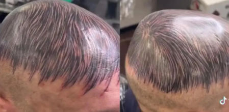 Los resultados del tatuaje son cuestionables