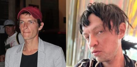 Deterioro físico de Camilín Blanes