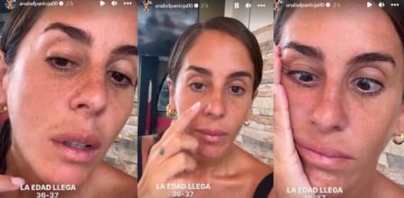 Anabel Pantoja muestra algunas marcas del sol a sus fans