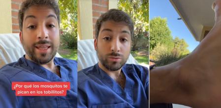 Farmacéutico Fernández explica por qué los mosquitos prefieren los tobillos.