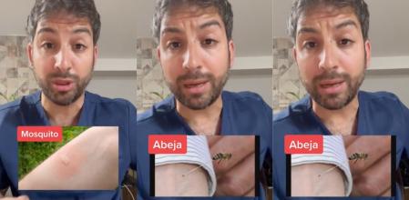 El Farmacéutico Fernández ilustra los tipos de picaduras en su cuenta