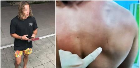 El chef asistió a comisaria con un arañazo en la espalda que sería crucial para el caso