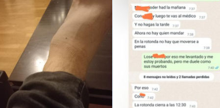El trabajador muestra el estado de su pie al su jefe