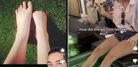 La historia de la mujer que perdió todos los dedos de un pie por culpa de un tratamiento de belleza con peces