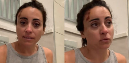 La terrorífica experiencia de una española con un elefante en un safari: “Me ha dado la paliza de mi vida”