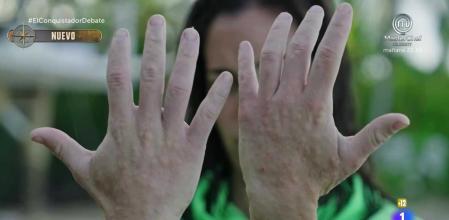 Los mosquitos jejenes, la peor pesadilla para los concursantes de 'El Conquistador'