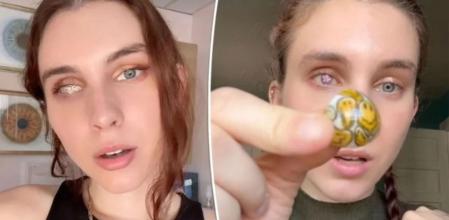 Le falta el ojo derecho y posee una impresionante colección de ojos falsos valorada en 170.000 dólares