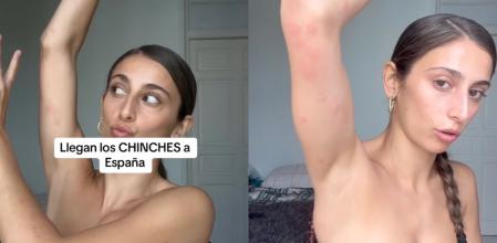 Una bailarina de Chanel explica su experiencia con las chinches.