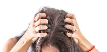 Cuero cabelludo sensible.