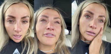 Se pone bótox dos días antes de su boda y se convierte en una auténtica pesadilla: "No parece una sonrisa humana"