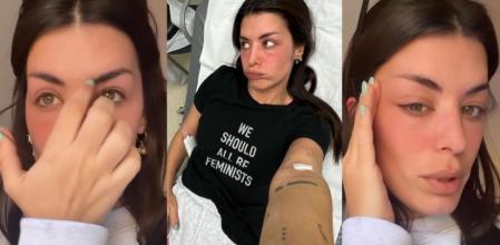 Dulceida, de urgencias con el rostro deformado