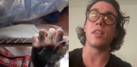 Toca la guitara mientras le extirpan un tumor cerebral para guiar al cirujano