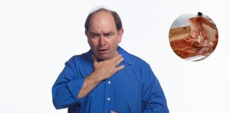 Casi 3.000 personas fallecieron por atragantamiento en España en 2021, según el INE.