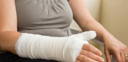 Una chica le hace un pulso a un desconocido en un bar y le rompe el brazo