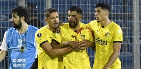 Oliveira, con el rostro ensangrentado tras la agresión