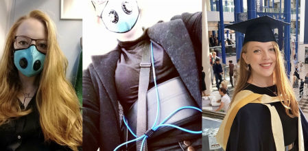 El drama de una joven que de la noche a la mañana se volvió alérgica a todo menos a 4 alimentos