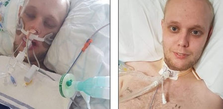 Los médicos decidieron inducirle el coma, pero advirtieron a la familia de Joseph que podría no despertar y que era incluso posible que falleciera