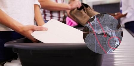 Pasa por la máquina de rayos X del aeropuerto y alucina al darse cuenta de lo que tiene incrustado en la cabeza