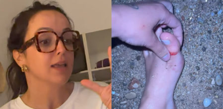 Sindy Takanashi mostrando su pie ensangrentado tras el incidente en la playa de Menorca