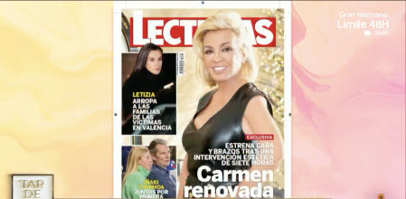 Sale a la luz la nueva imagen de Carmen Borrego tras siete horas de operación: 