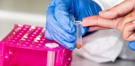 Muestra de sangre para analizar con el biosensor Celifast el cual determina si una persona es celiaca. Laboratorio del departamento de quimica de la Facultad de Ciencias de la UAB. Bellaterra. Foto Gemma Miralda.