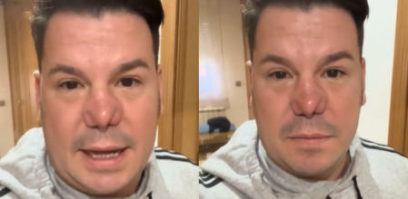 Lucas González, de 'Andy y Lucas', reaparece en sus redes tras su comentada intervención en 'El Hormiguero': ''Estoy sobrepasado''