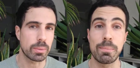 Alex Docampo, dermatólogo: ''Usar un exceso de hidratantes, no elimina las arrugas''