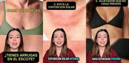 Marta Díez comparte cómo evitar y tratar las arrugas en el escote