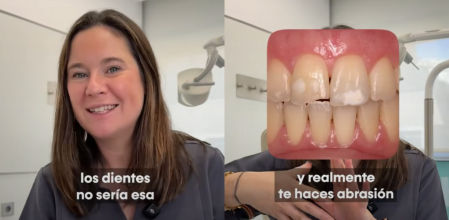La ortodoncista Almudena Herraiz recomienda acudir al dentista para realizar un blanqueamiento seguro y efectivo