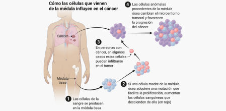 Como las células que vienen de la médula influyen en el cáncer