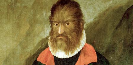 Petrus Gonzalvus, o Gonsalvus. Detalle de un retrato de la colección del archiduque Fernando, castillo de Ambras