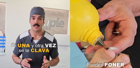 Colocar un trozo de algodón en la esquina de la uña puede prevenir que se encarne de nuevo 