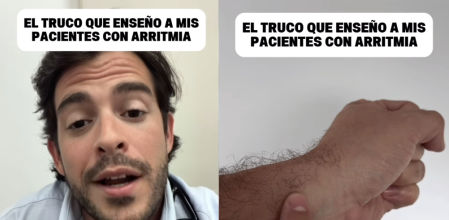 Aurelio Rojas, cardiólogo: “Con esta maniobra que puedes realizar por ti mismo puedes saber si ese episodio de palpitaciones o taquicardia que sufres es una arritmia”