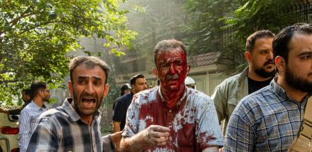 Un hombre herido en Teherán, tras uno de los bombardeos de Israel I