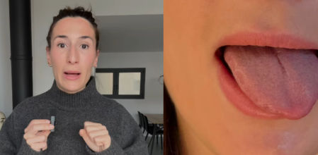 La doctora Beatriz Moralejo alerta sobre las marcas en lengua y mejillas como posibles señales de bruxismo nocturno.