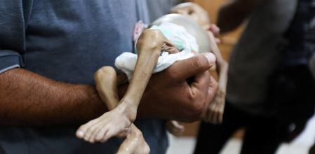 La criatura palestina d’onze mesos Zainab Abu Halib, morta per desnutrició, ahir a Khan Iunis