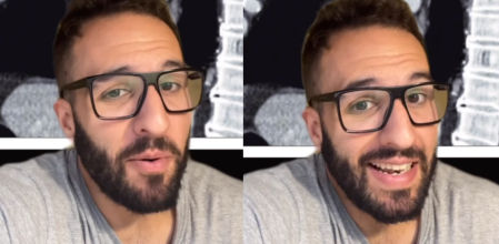 Jorge Martín, médico: ''Algunas personas padecen el fenómeno raro llamado 'disfagia lusoria'. Tienen dificultad para tragar porque una arteria les aprieta el esófago''