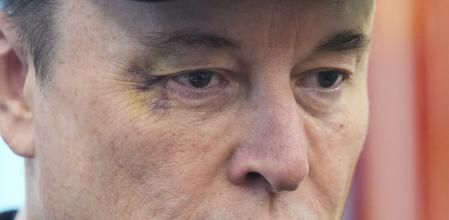 Elon Musk cerró su ruinosa etapa en el gobierno Trump con una comparecencia en que mostró un ojo amoratado, herida causada al jugar con su hijo, según dijo
