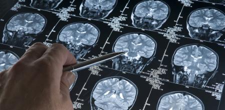 La activación de ciertas zonas del cerebro potencian la respuesta del sistema inmunitario&nbsp;