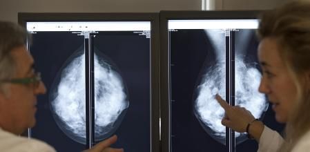 Imagen de archivo de una mamografía realizada en el hospital Vall d'Hebron&nbsp;